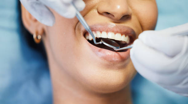Best Broken Tooth Emergency  in Kirtland, OH